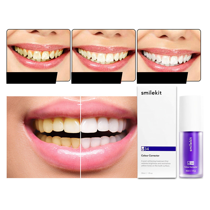 30ml Tooth Whitening Toothpaste Removes Tooth Stains V34 Tooth White Products Beautiful White Teeth Tooth Restoration Products