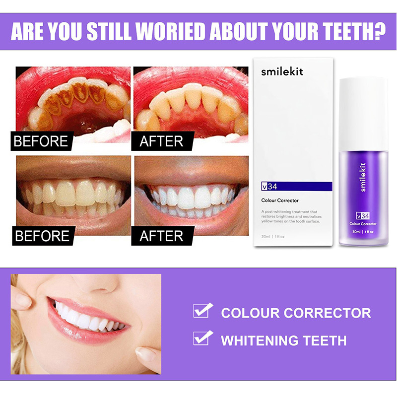 30ml Tooth Whitening Toothpaste Removes Tooth Stains V34 Tooth White Products Beautiful White Teeth Tooth Restoration Products