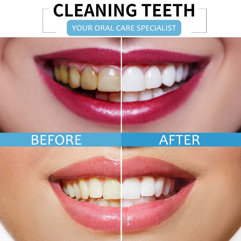 Baking Soda Toothpaste Teeth Whitening Cleansing Teeth Stains Removal Breath Freshen Fruit Flavor Tooth Paste Teeth Whitening