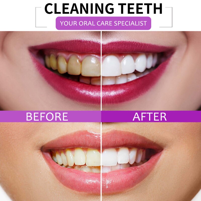 Baking Soda Toothpaste Teeth Whitening Cleansing Teeth Stains Removal Breath Freshen Fruit Flavor Tooth Paste Teeth Whitening