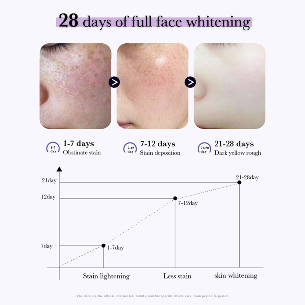 Nicotinamide Whitening Freckles Cream Remove Melasma Dark Spot Acne Marks Lightening Melanin Brightens Skin Tone Face Skin Care