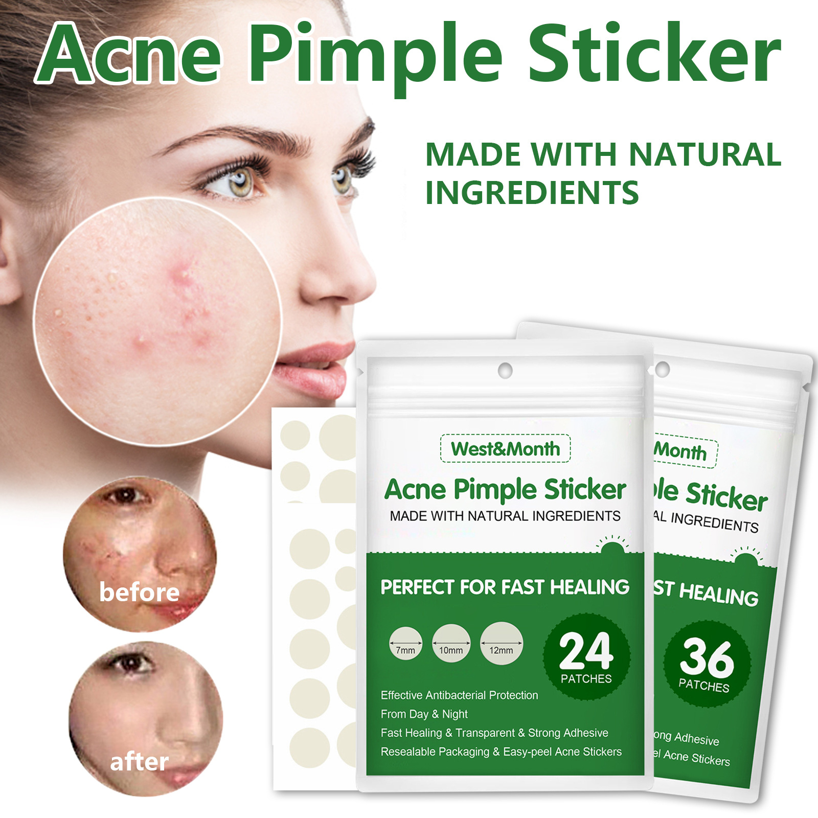 Natural Ingredients Acne Pimple Sticker Hydrocolloid Patch Acne Remover Treatment Blemish Spot Skin Care Beauty Tools