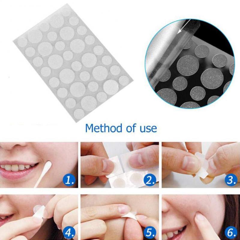 Acne Pimple Patch Sticker Acne Treatment Pimple Remover Tool Blemish Spot Facial Mask Skin Care маска для лица