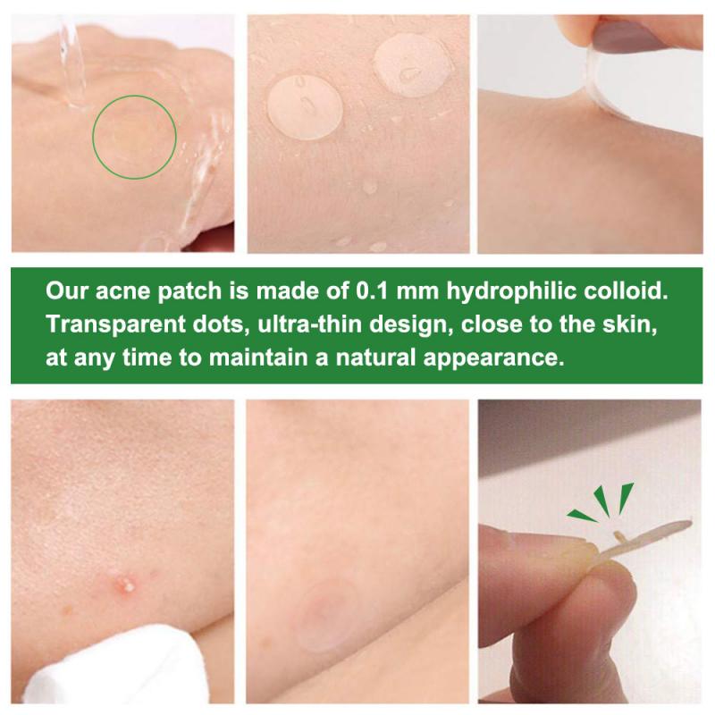 Acne Pimple Patch Sticker Acne Treatment Pimple Remover Tool Blemish Spot Facial Mask Skin Care маска для лица