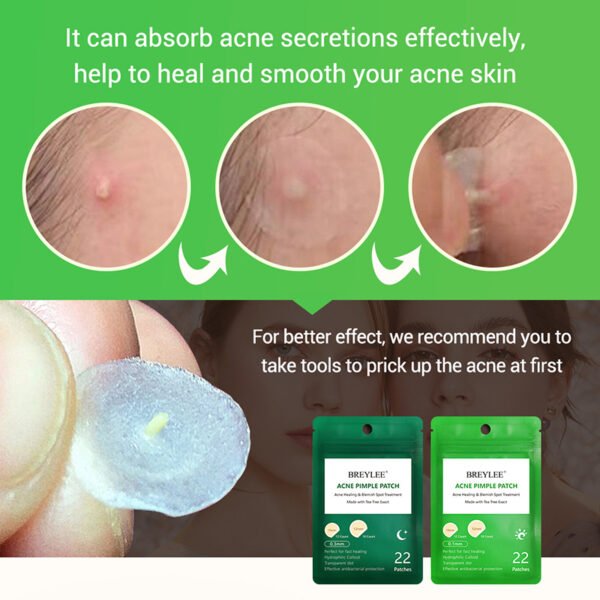 0.1mm Acne Pimple Patch Stickers Waterproof Acne Treatment Pimple Remover Tool Blemish Spot Facial Mask Skin Care 22 patches/bag - Image 3