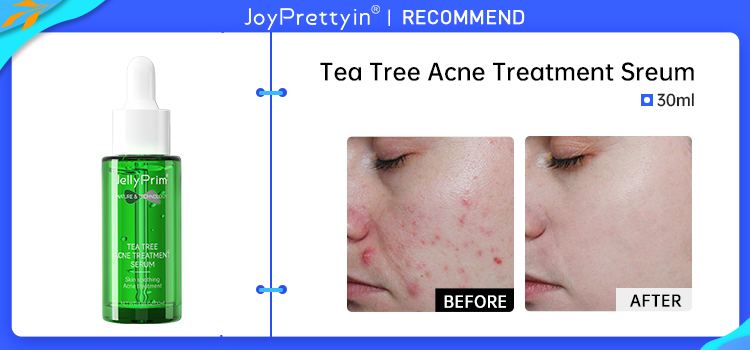 Acne Treatment Facial Mask Natural Tea Tree Pore Cleaning Blackhead Remove Oil Control Pimple Skin Care Products Face Clay Mask