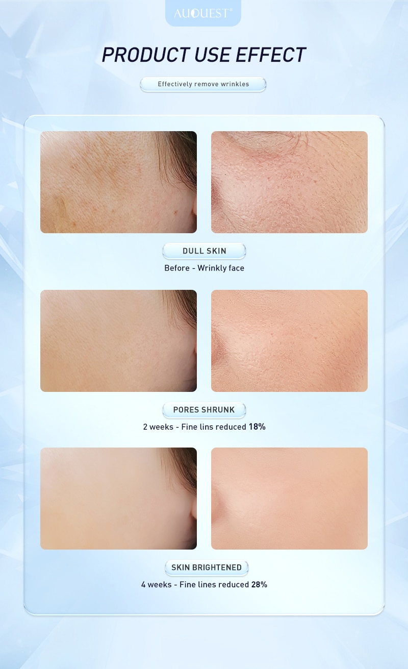 AUQUEST Retinol Skin Care Set Anti-Wrinkle Cream Whitening Mosturizing Serum Skincare Facial Product Kits Beauty Health 4PCS